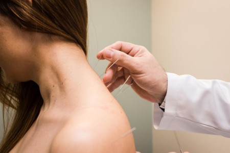 acupuntura clinica adg saude fisioterapia.jpg